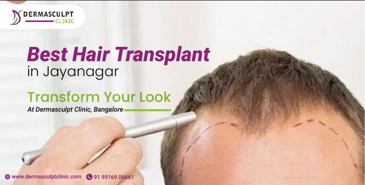 Best Hair Transplant in Jayanagar: Transform Your Look at Dermasculpt Clinic, Bangalore