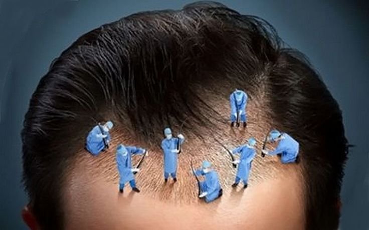 Revitalize Your Confidence: Top-Notch Hair Transplant Solutions at Dermasculpt Clinic, Jayanagar Bangalore